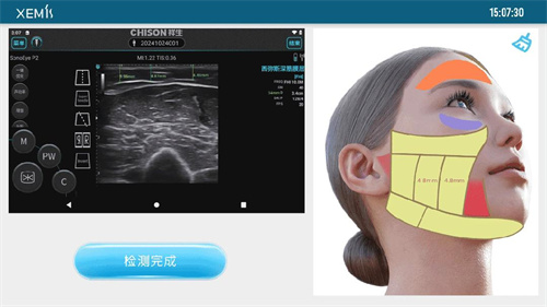 医美届的烂摊子 “馒化脸”是否有破局之道？
