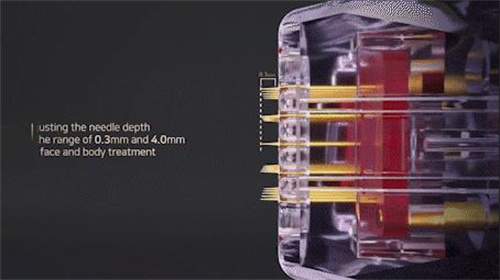 Sylfirm X黑曜双波如何创造皮肤科增量3.jpg