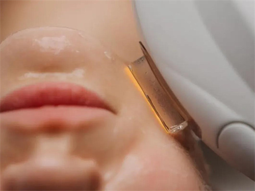 超声仪器政策变动 医美行业未来走向如何？4.jpg